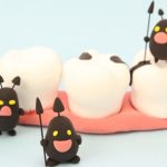 虫歯と歯周病の違いをご存じですか？原因・症状やセルフチェック方法